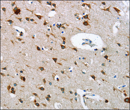 Anti-CTSL antibody produced in rabbit