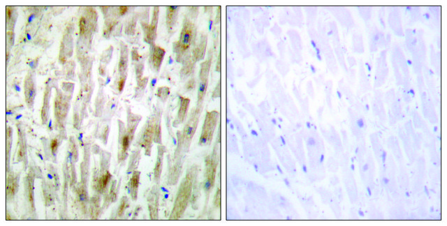 Anti-LIMK2 antibody produced in rabbit
