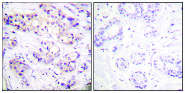 Anti-PKC ? antibody produced in