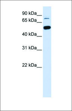 Anti-SMARCD1 antibody produced in rabbit