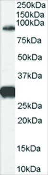 Anti-FOXP2 (Internal) antibody produced in