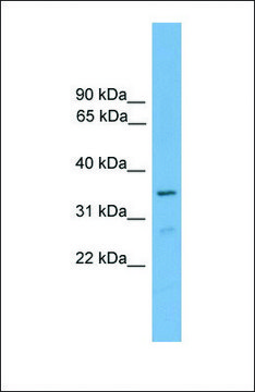 Anti-FOXI2, (C-terminal) antibody produced in