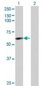 Anti-CAMK2D antibody produced in rabbit