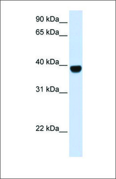 Anti-FOXE1 antibody produced in rabbit