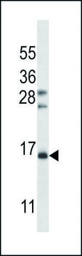 ANTI-FSHB/FSH (CENTER) antibody produced in