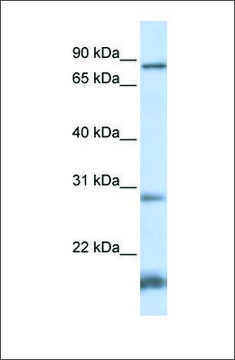 Anti-SMYD4 antibody produced in rabbit