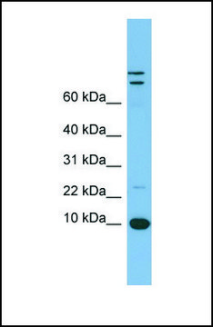 Anti-TFF1 antibody produced in rabbit