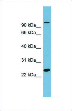 Anti-SEMA3D antibody produced in rabbit