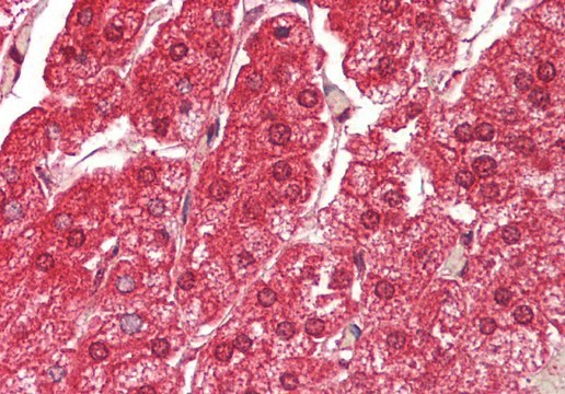 Anti-ATE1 antibody produced in rabbit