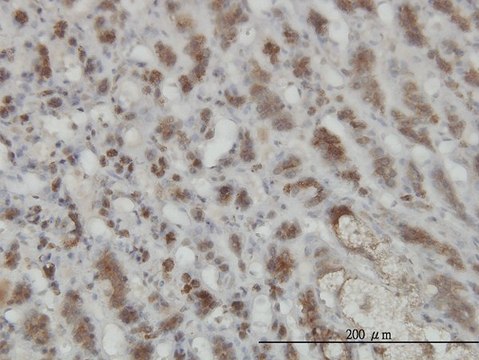 Monoclonal Anti-GMPPB antibody produced in