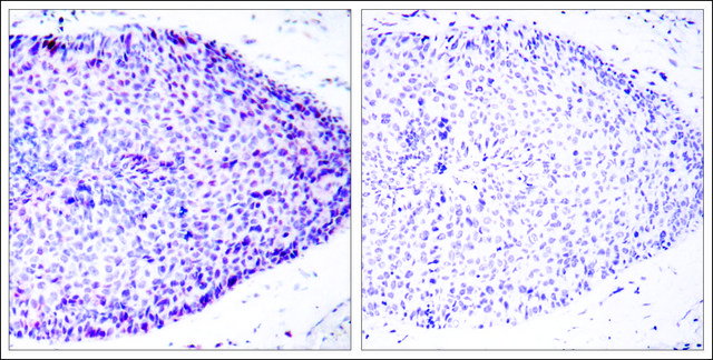 Anti-ATF2 (Ab-62 or 44) antibody