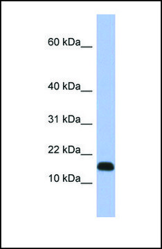 Anti-RPL37A antibody produced in rabbit