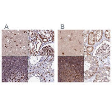 Anti-TOR1AIP1 antibody produced in rabbit