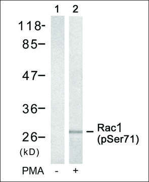 Anti-phospho-RAC1 (pSer?¹) antibody produced in
