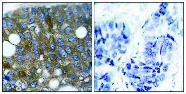 Anti-phospho-HSPB1 (pSer¹?) antibody produced in