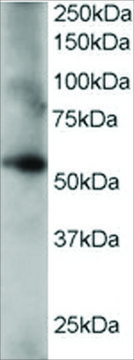 Anti-Coronin 3/Coronin 1C antibody produced