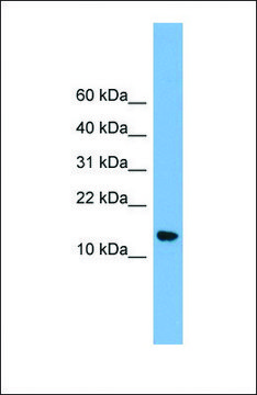 Anti-LSM8, (N-terminal) antibody produced in