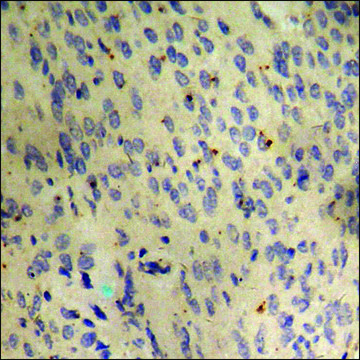Anti-phospho-p53 (pSer³??) antibody produced in