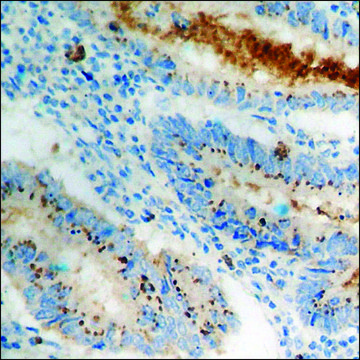 Anti-phospho-Cortactin (pTyr???) antibody produced in