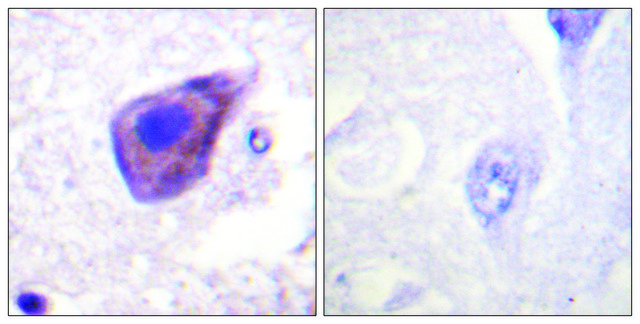 Anti-GZ-? antibody produced in rabbit