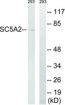 Anti-SLC5A2 antibody produced in rabbit