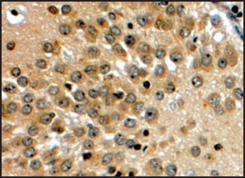 Anti-NOTCH3 (C-terminal) antibody produced in