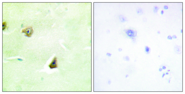 Anti-DUSP6 antibody produced in rabbit
