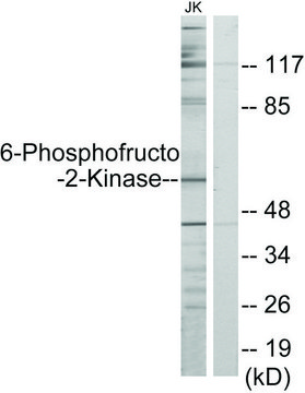 Anti-6-Phosphofructo-2-Kinase, N-Terminal antibody produced in
