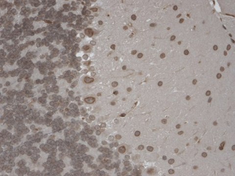 Monoclonal Anti-TRPM7 antibody produced in