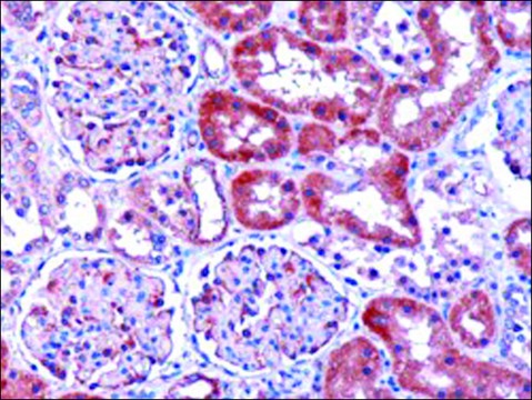 Anti-Dicarbonyl Reductase antibody produced in