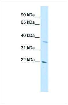 Anti-DDIT4L antibody produced in rabbit