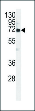 ANTI-VWA2 (N-TERM) antibody produced in