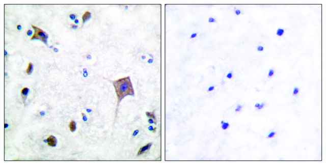 Anti-PYK2 antibody produced in rabbit