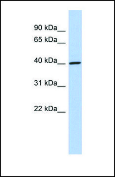 Anti-DDI1 antibody produced in rabbit