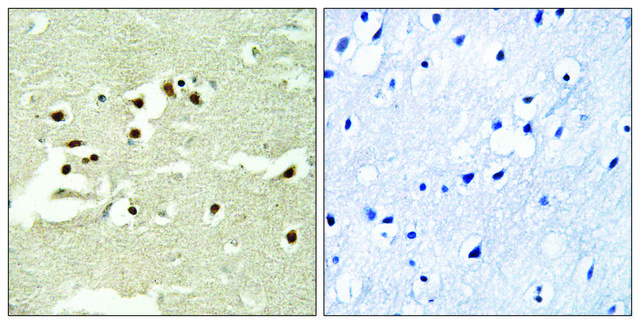 Anti-NCOA5 antibody produced in rabbit