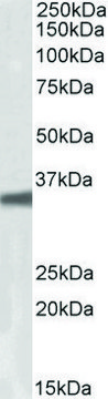 Anti-GNB3 antibody produced in goat