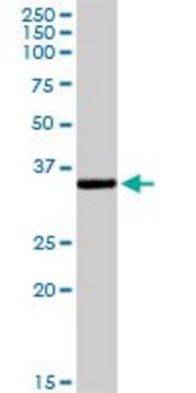 Anti-UNG antibody produced in rabbit