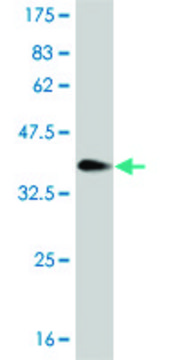 ANTI-LHX1 antibody produced in mouse
