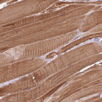 Anti-FAM65C antibody produced in rabbit