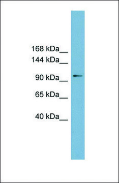 Anti-FTSJD1 antibody produced in rabbit