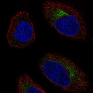 Anti-CCR10 antibody produced in rabbit