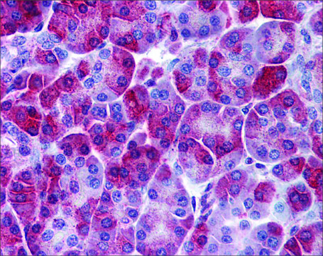 Anti-SQSTM1 antibody produced in rabbit