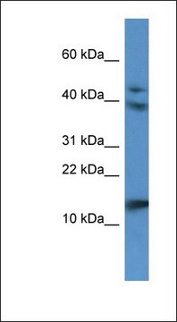 Anti-RETNLB antibody produced in rabbit