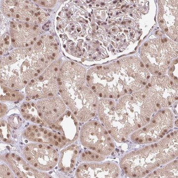 Anti-GTF3C6 antibody produced in rabbit