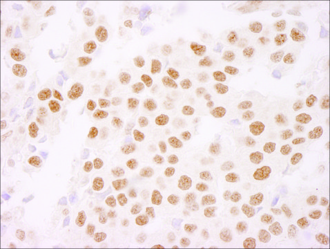 Rabbit anti-Ki-67 IHC Antibody, Affinity