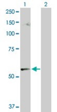 Anti-CABC1 antibody produced in rabbit