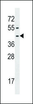 ANTI-FPR1 (CENTER) antibody produced in