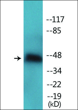 Anti-phospho-Aurora Kinase (pThr²??) antibody produced