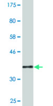 Monoclonal Anti-CDY2A antibody produced in
