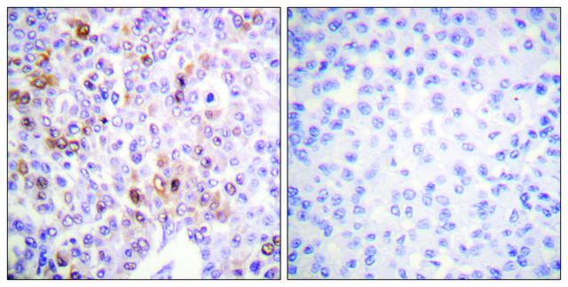 Anti-Histone H4 (Acetyl-Lys¹?) antibody produced